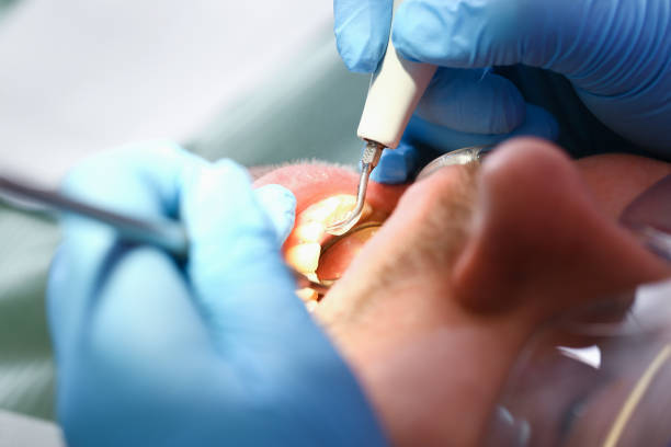 Best Emergency Treatment for Oral Infections in Hortonville, WI