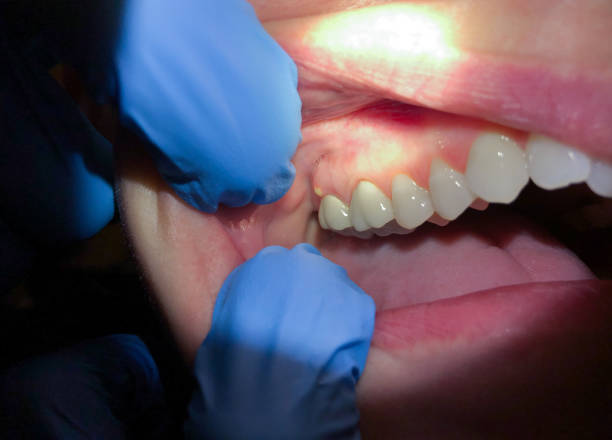 Best Emergency Orthodontic Repairs in Hortonville, WI