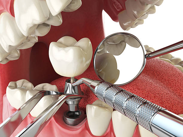 Best Emergency Treatment for Jaw Pain or Injury in Hortonville, WI